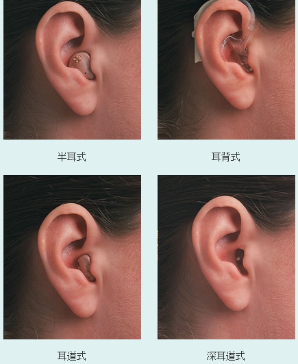 助听器款式怎么选？看完再也不踩坑