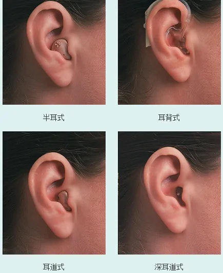 助听器款式怎么选？看完再也不踩坑