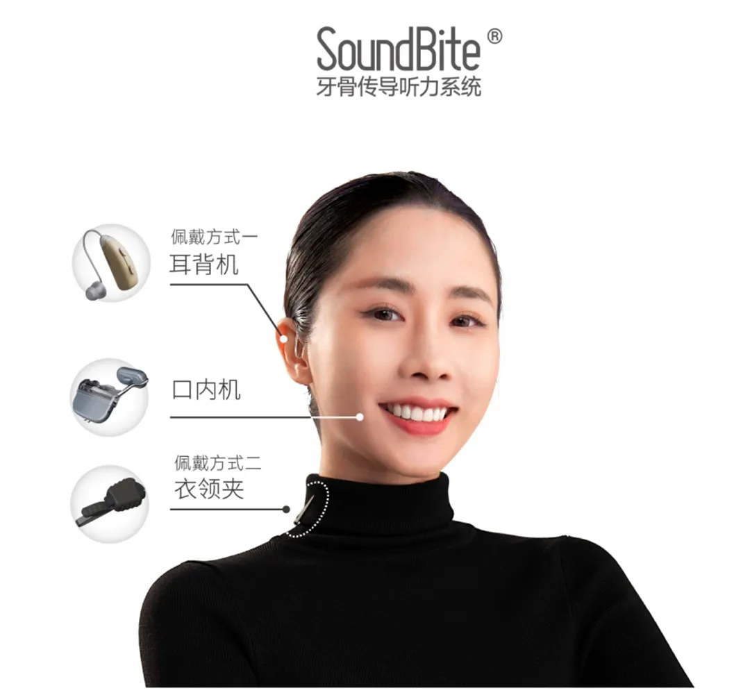 声佗品聆 G4（SoundBite G4）标准耳背款｜牙骨传导听力系统牙骨导助听器